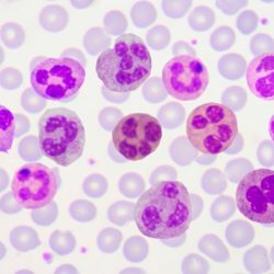 Neutrophils absolute function high low contents blood